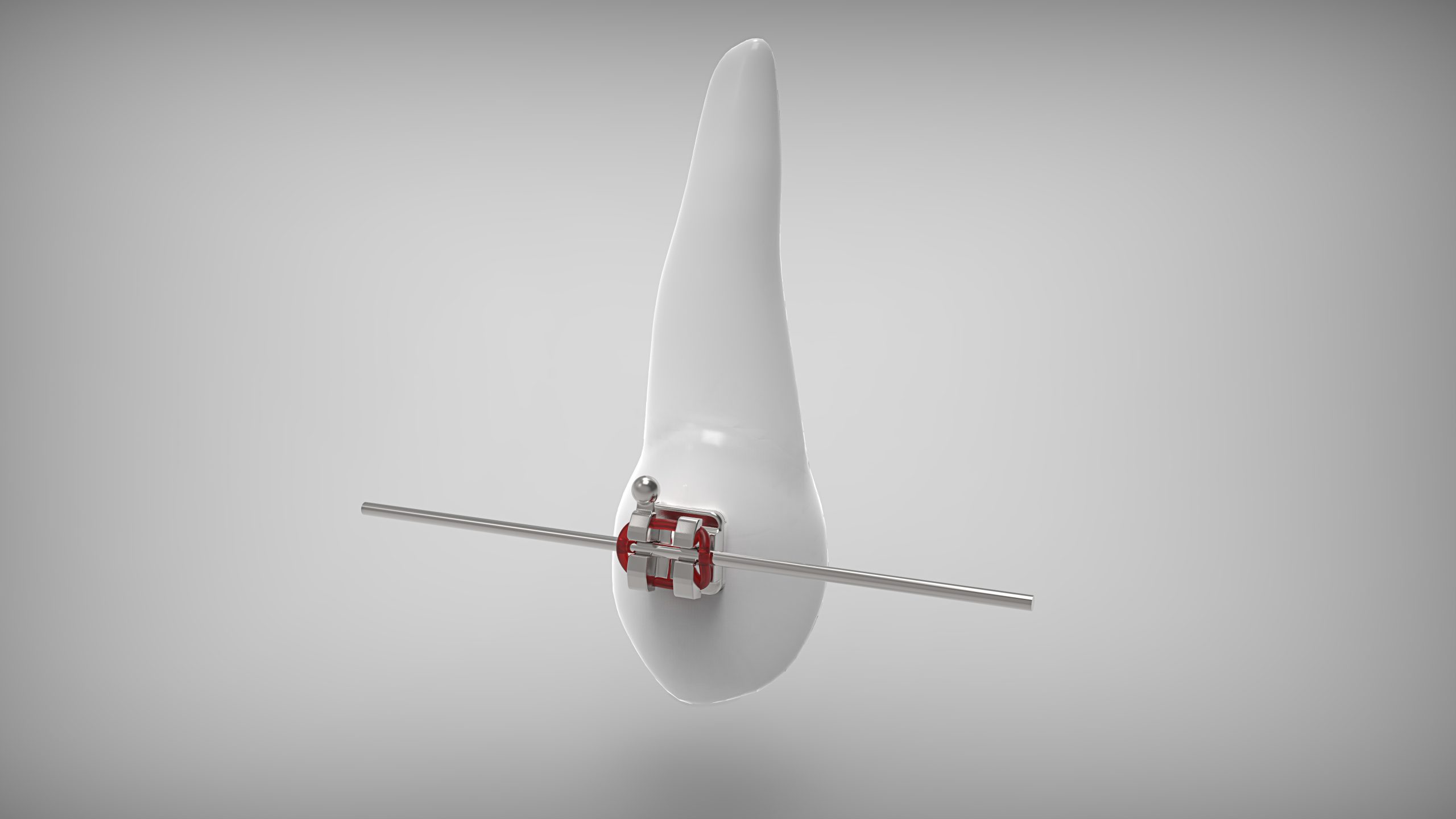 Tratamiento de ortodoncia