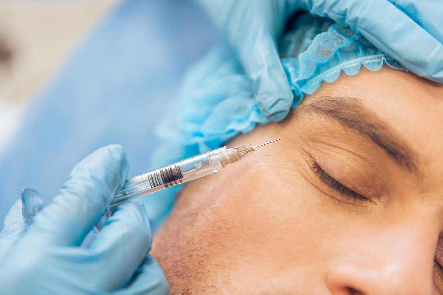 uso de toxina botulínica en la cara